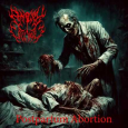 Postpartum Abortion (SINGLE)